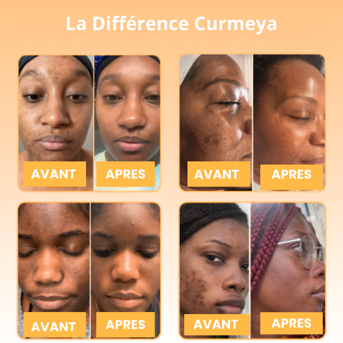 Le Coffret "Renaissance Éclat"