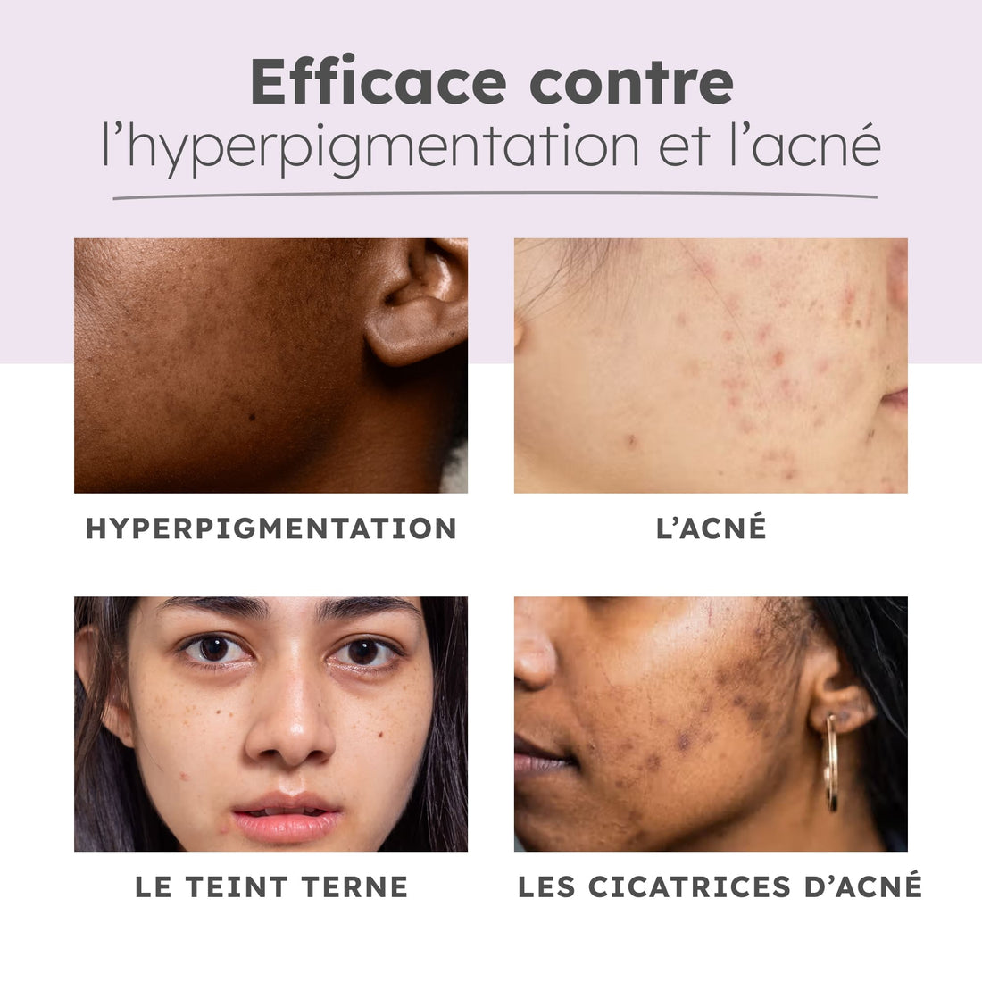 Le Coffret "Renaissance Éclat"